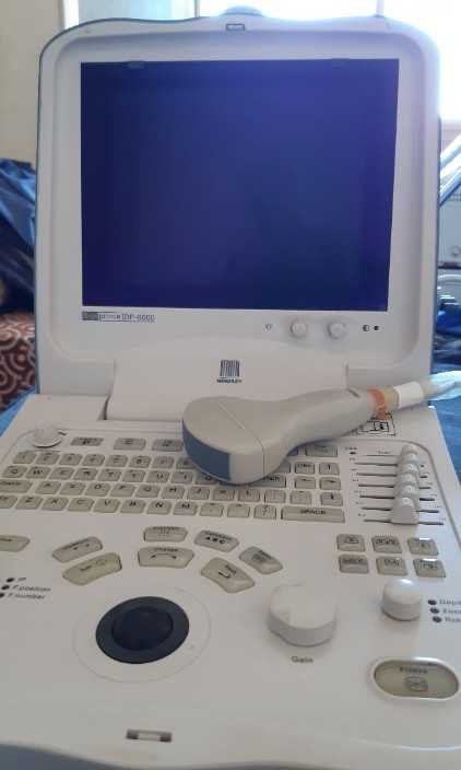 Materiel medical échographe