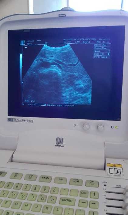 Materiel medical échographe