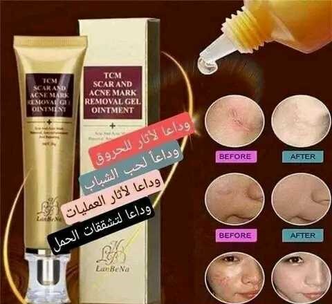 كريم علاج السيكاتريس حب الشباب واتاره التجاعيد.